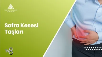 Safra Kesesi Taşları