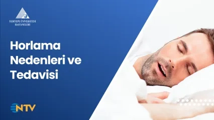 Horlama Nedenleri ve Tedavisi