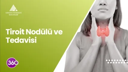 Tiroit Nodülü ve Tedavisi 