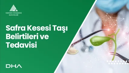 Safra Kesesi Taşı Belirtileri ve Tedavisi 