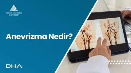 Anevrizma Nedir?