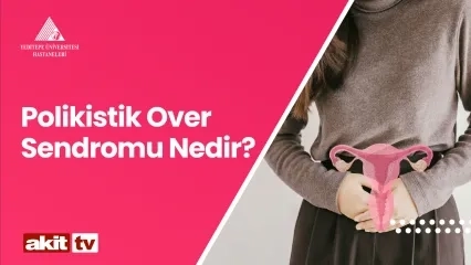 Polikistik Over Sendromu ve Tedavisi