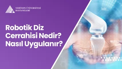 Robotik Diz Cerrahisi Nedir? Nasıl Uygulanır?