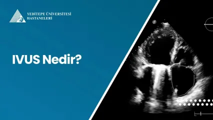 IVUS Nedir? 