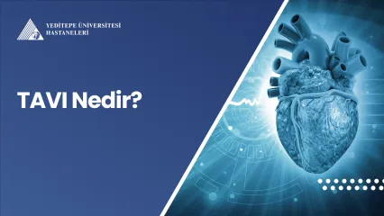 TAVI Nedir? Kimlere Uygulanır? 
