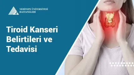 Tiroid Kanseri Belirtileri ve Tedavisi 