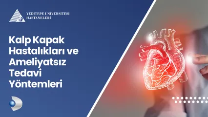 Kalp Kapak Hastalıkları ve Ameliyatsız Tedavi Yöntemleri 