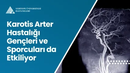 Karotis Arter Hastalığı Gençleri ve Sporcuları da Etkiliyor