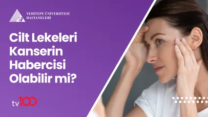 Cilt Lekeleri Kanserin Habercisi Olabilir mi?