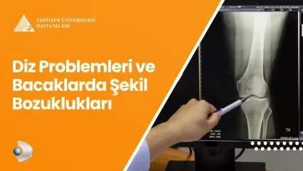 Diz Problemleri ve Bacaklarda Şekil Bozuklukları 