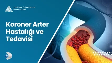Koroner Arter Hastalığı ve Tedavisi 