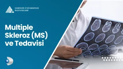 Multiple Skleroz (MS) ve Tedavisi