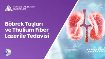 Böbrek Taşları ve Thulium Fiber Lazer ile Tedavisi 