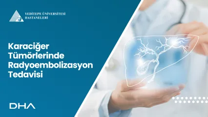 Karaciğer Tümörlerinde Radyoembolizasyon Tedavisi
