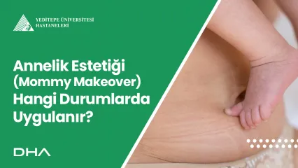 Annelik Estetiği (Mommy Makeover) Hangi Durumlarda Uygulanır?