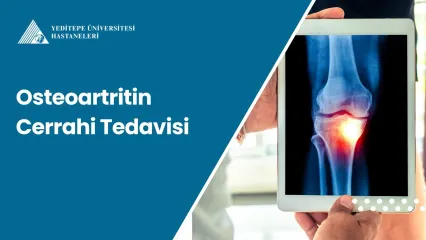 Osteoartritin Cerrahi Tedavisi