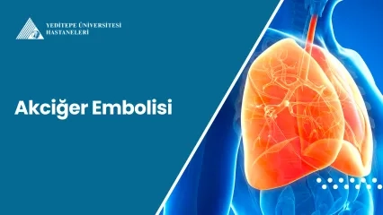 Akciğer Embolisi