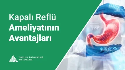 Kapalı Reflü Ameliyatının Avantajları