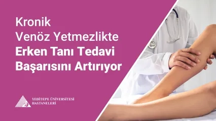 Kronik Venöz Yetmezlikte Erken Tanı Tedavi Başarısını Artırıyor