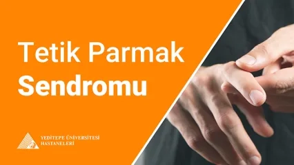 Tetik Parmak Sendromu