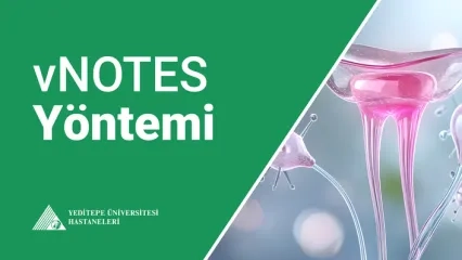 vNOTES Nedir?