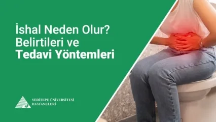 İshal Nedir?