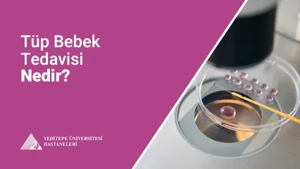 Tüp Bebek Tedavisi
