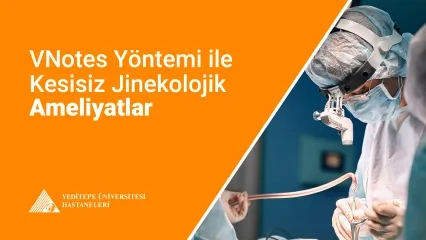VNotes Yöntemi
