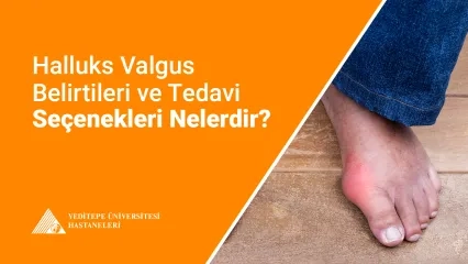  Halluks Valgus Belirtileri ve Tedavi Seçenekleri 