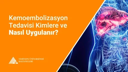  Kemoembolizasyon Tedavisi