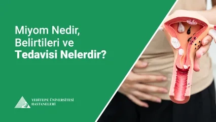 Miyom Nedir?