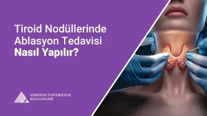  Tiroid Nodüllerinde Ablasyon Tedavisi 