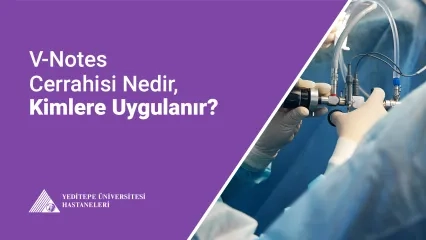  V-NOTES Cerrahisi