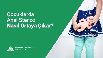Anal Stenoz