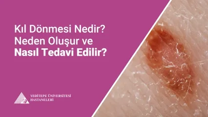 Kıl Dönmesi